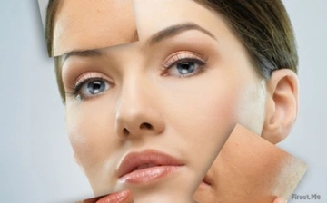 Leke Tedavisi Leke Nasıl Tedavi Edilir?